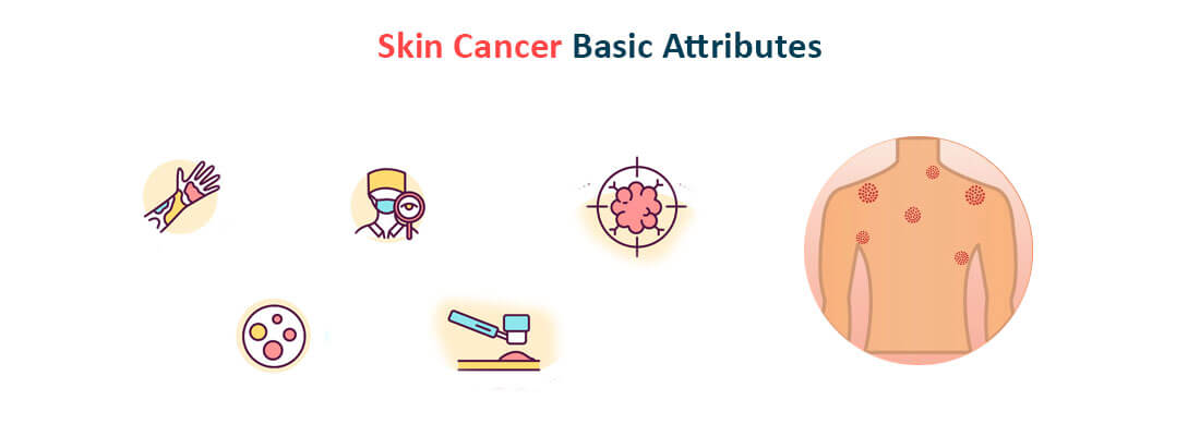 Delve Into Skin Cancer: Its Biopsy, Blood Tests and Molecular Testing ...