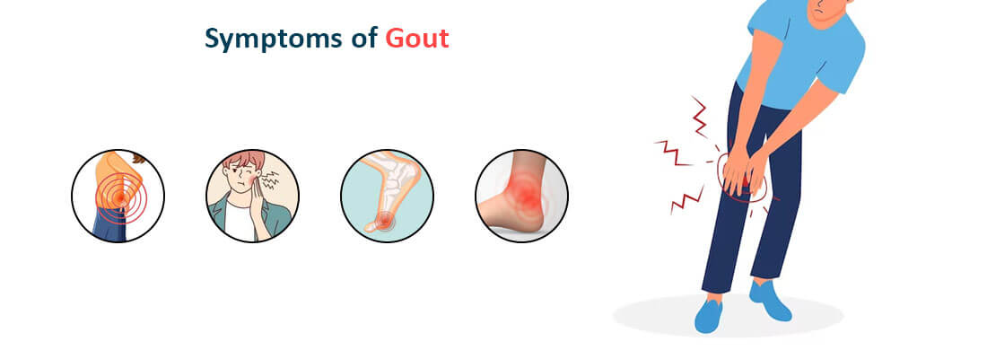 What Is Gout? Learn About The Symptoms, Diagnosis and Treatment ...