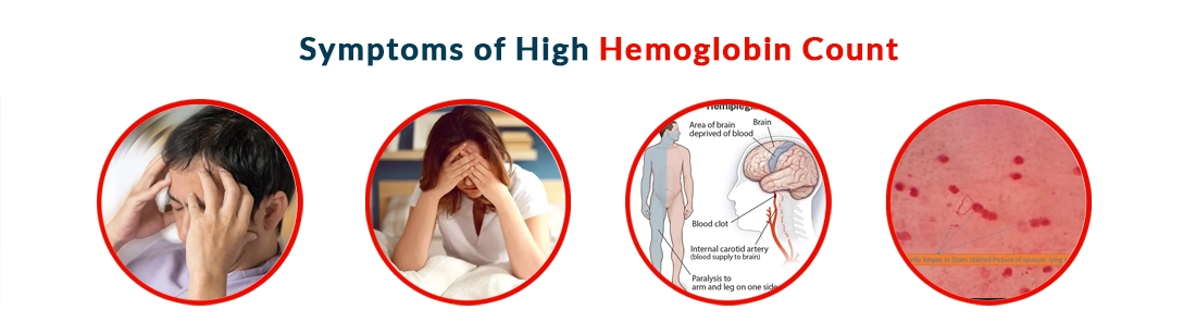 High Hemoglobin Count: Causes, Symptoms and Treatment