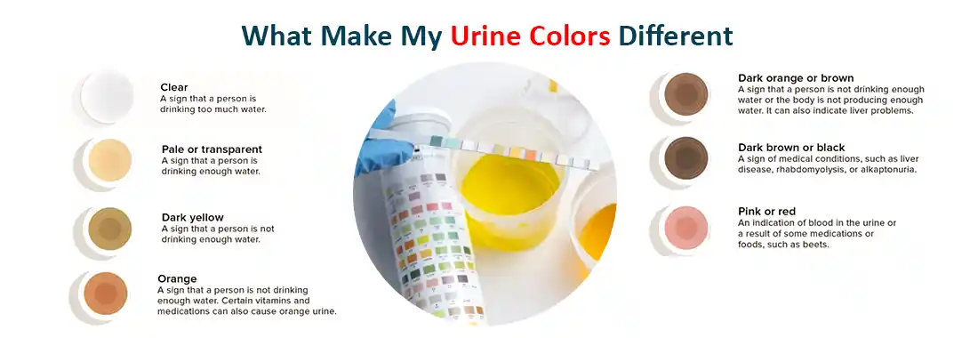 What causes orange urine? Related conditions and treatments