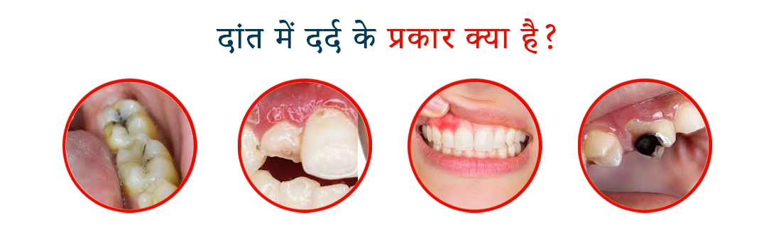 7 Easy Ways To Make dental whitening Dwarka Faster