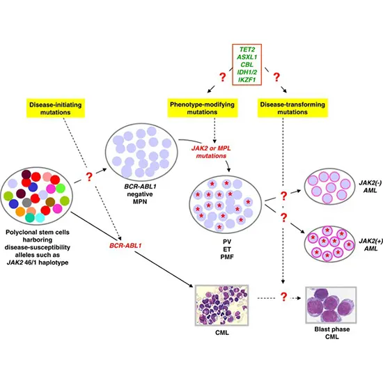 Polycythaemia Vera and Myeloproliferative Other Neoplasms: Overview