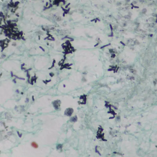 Geotrichum Candidum : Understanding The Benefits and Risks Of This ...