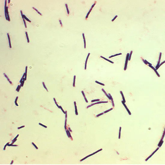 Understanding Clostridium Perfringens : Causes Symptoms and Prevention ...