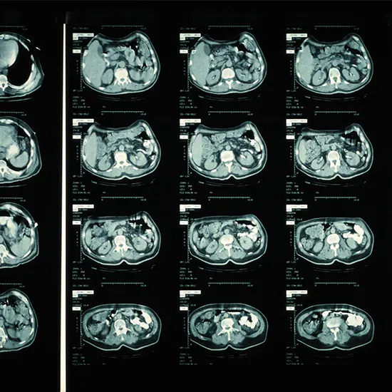 What Is The Cost Of CT Scan? | Ganesh Diagnostic