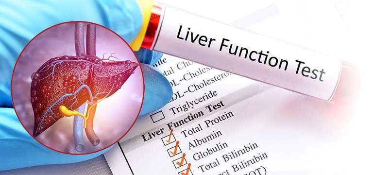 LFT Blood Test: A Comprehensive Guide