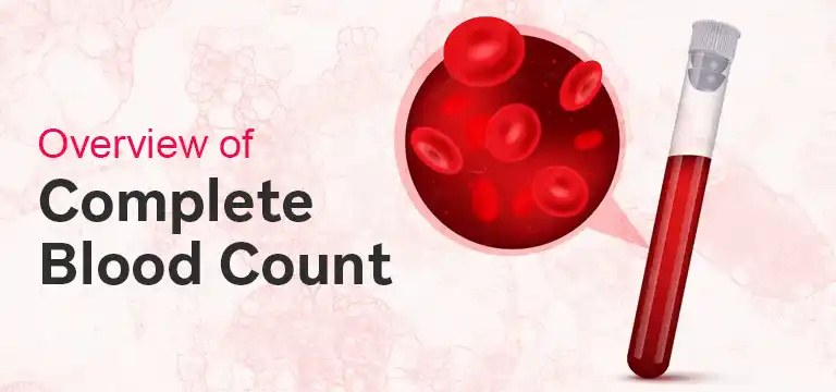 An Overview of Complete Blood Count Test: Purpose, Preparation, Result  Interpretation & Cost