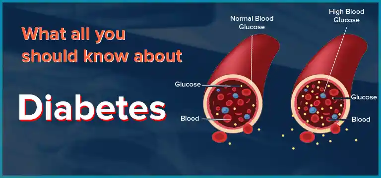 What All You Should Know About - Diabetes | Ganesh Diagnostic