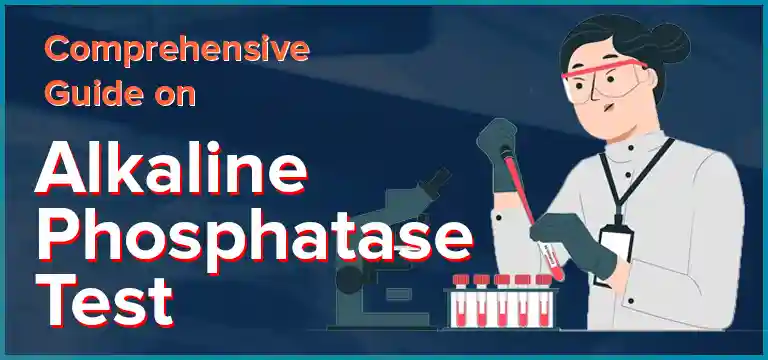 Comprehensive Guide on Alkaline Phosphatase Test | Ganesh