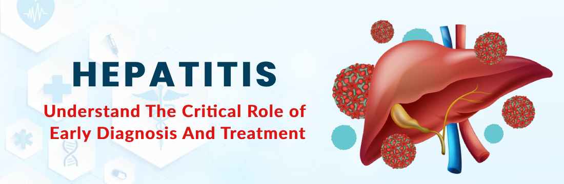 Hepatitis: Understand the Critical Role of Early Diagnosis and Treatment