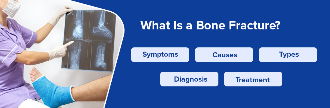 What is Bone Fracture : Its Symptoms, Causes, Types, Diagnosis And ...