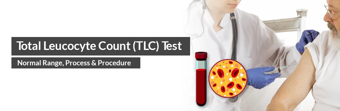 Total Leucocyte Count (TLC) Test - Normal Range, Process, Procedure