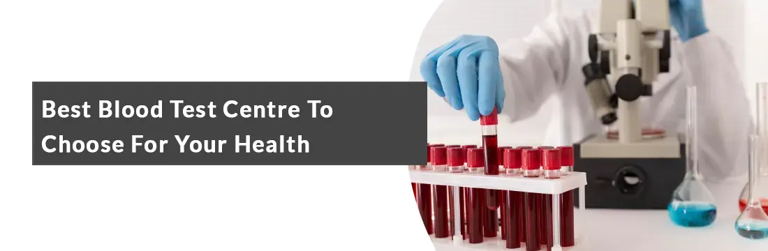 Best Blood Test Centre To Choose For Your Health