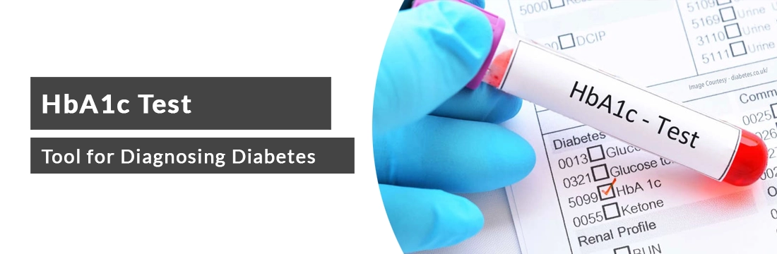 HbA1c Test : Tool for Diagnosing Diabetes