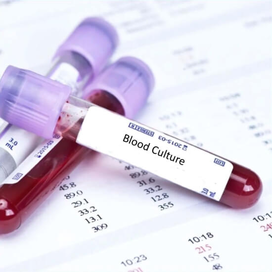 Book Rapid Blood Culture and Sensitivity | Test Price In Delhi | Ganesh ...