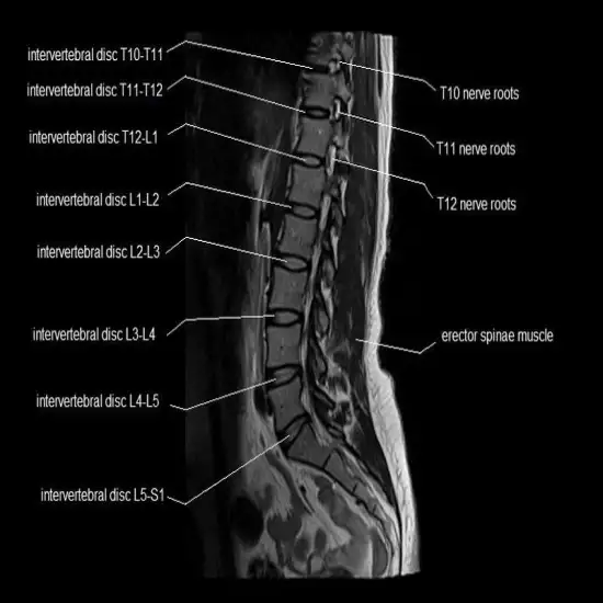 CT Dorsal Spine | Test Price in Delhi | Ganesh Diagnostic