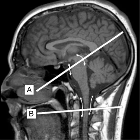 B-Flow, Radiology Reference Article