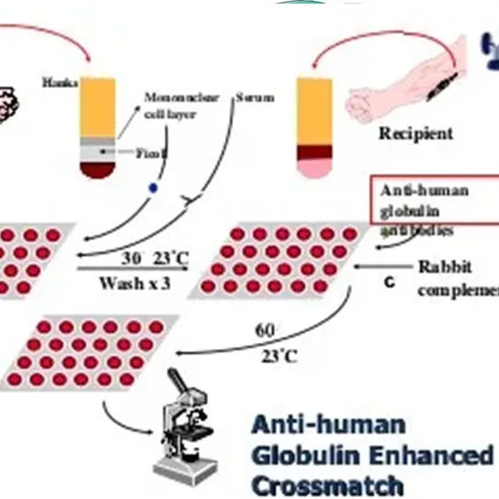 Panel Reactive Antibody (PRA) | Test Price In Delhi | Cost Near Me 