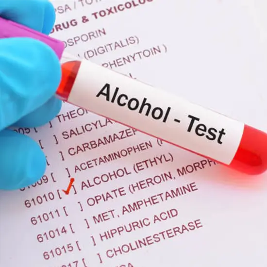 Alcohol (Serum) Test In Delhi : Alcohol (Serum) Test At Home @ Best Prices