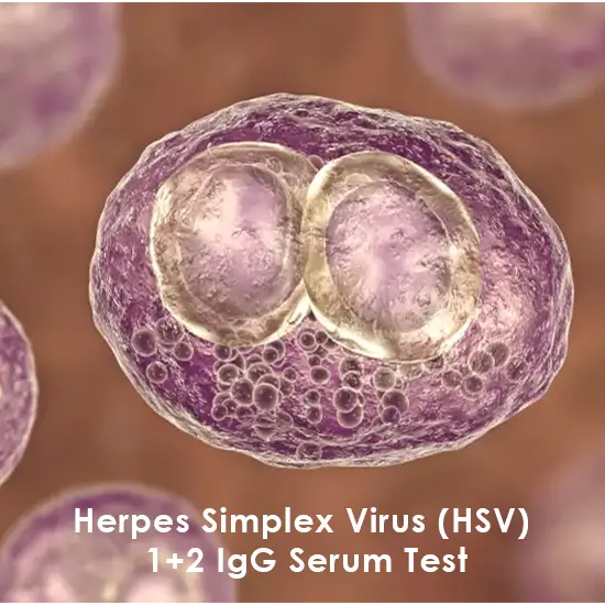 Herpes Simplex Virus (HSV) 1+2 Antibodies Panel IgG & IgM, Serum Test
