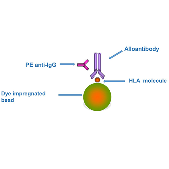 HLA-Panel Reactive IgG Antibodies (PRA) Screen | Test In Delhi 