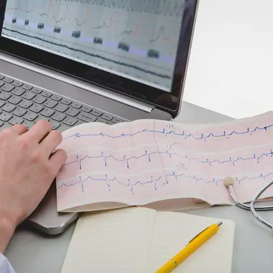 electrocardiogram (ecg) test